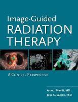 Image guided radiation therapy