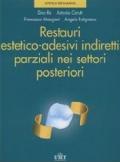 Restauri estetico-adesivi indiretti parziali nei settori posteriori