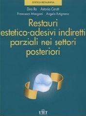 Restauri estetico-adesivi indiretti parziali nei settori posteriori