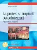 La protesi su impianti osteointegrati. Procedure cliniche. Con CD-ROM