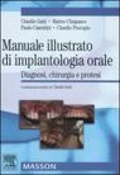 Manuale illustrato di implantologia orale. Diagnosi, chirurgia e protesi. Ediz. illustrata