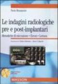 Le indagini radiologiche pre e post-implantari. Metodiche di esecuzione. Errori. Lettura