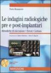 Le indagini radiologiche pre e post-implantari. Metodiche di esecuzione. Errori. Lettura