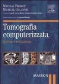 Tomografia computerizzata. Spirale e multistrato