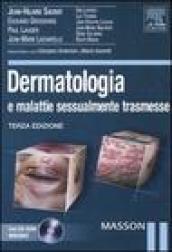 Dermatologia e malattie sessualmente trasmesse. Con CD-ROM