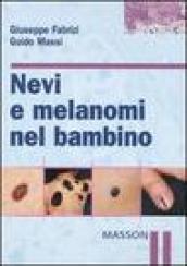 Nevi e melanomi nel bambino