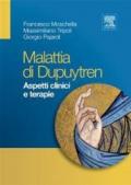 La malattia di Dupuytren