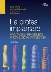 La protesi implantare. Vantaggi, problemi e soluzioni pratiche