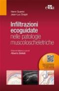 Infiltrazioni ecoguidate nelle patologie muscoloscheletriche