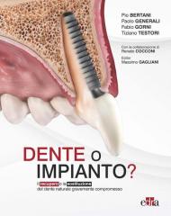 Dente o impianto? Il recupero o la sostituzione del dente naturale gravemente compromesso