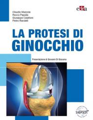 La protesi di ginocchio