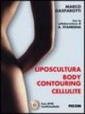 Liposcultura body contouring cellulite. Con DVD