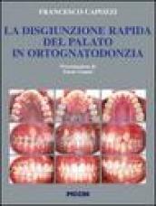 La disgiunzione rapida del palato in ortognatodonzia Aspetti concettuali ed operatività clinica