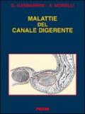 Malattie del canale digerente