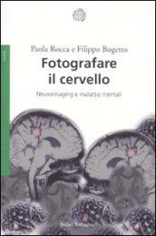 Fotografare il cervello. Neuroimaging e malattie mentali