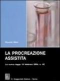 La procreazione assistita