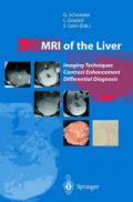 Mri of the liver. Imaging techniques, contrast enhancement, differential diagnosis