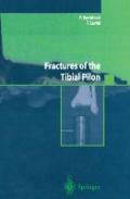Fractures of the tibial pilon. Ediz. inglese