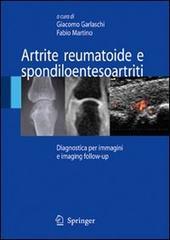 Artrite reumatoide e spondiloentesoartriti