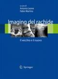 Imaging del rachide. Il vecchio e il nuovo