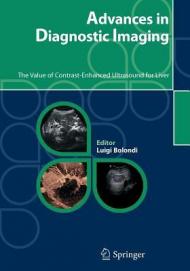 Advances in diagnostic imaging. The value of contrast-enhanced ultrasound for liver