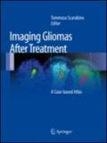 Imaging gliomas after treatment