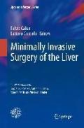 Minimally invasive surgery of the liver. Con DVD