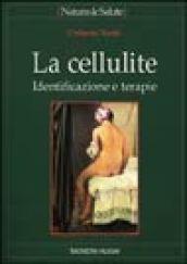 La cellulite. Identificazione e terapie