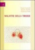 Malattie delle tiroide