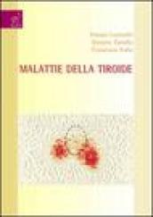 Malattie delle tiroide