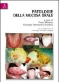 Patologie della mucosa orale