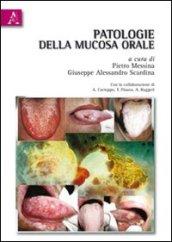 Patologie della mucosa orale