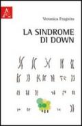 La sindrome di Down