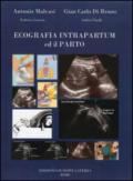 Ecografia intrapartum ed il parto