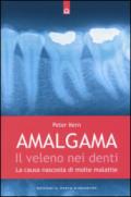 Amalgama. Il veleno nei denti. La causa nascosta di molte malattie