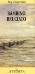 Bambino bruciato