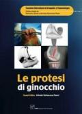 Le protesi di ginocchio