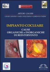 Impianto cocleare. Cause organiche e inorganiche di reintervento