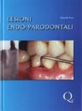 Lesioni endo-parodontali