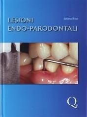 Lesioni endo-parodontali