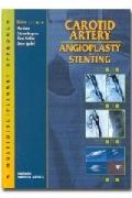 Carotid artery and angioplasty stenting