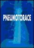 Pneumotorace