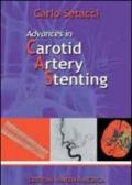 Advances in carotid artery stenting