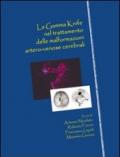 La Gamma Knife nel trattamento delle malformazioni artero-venose cerebrali