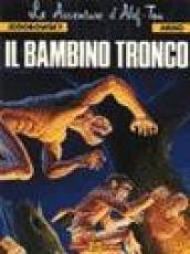 Il bambino tronco