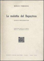 La malattia del Dupuytren