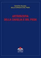 Artroscopia della caviglia e del piede. Società italiana della caviglia e del piede