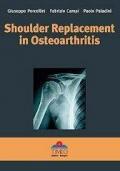Shoulder replacement in osteoarthritis