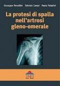 La protesi di spalla nell'artrosi gleno-omerale