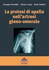 La protesi di spalla nell'artrosi gleno-omerale